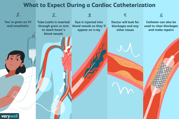 Percutaneous carotid catheterization and arteriogram were performed